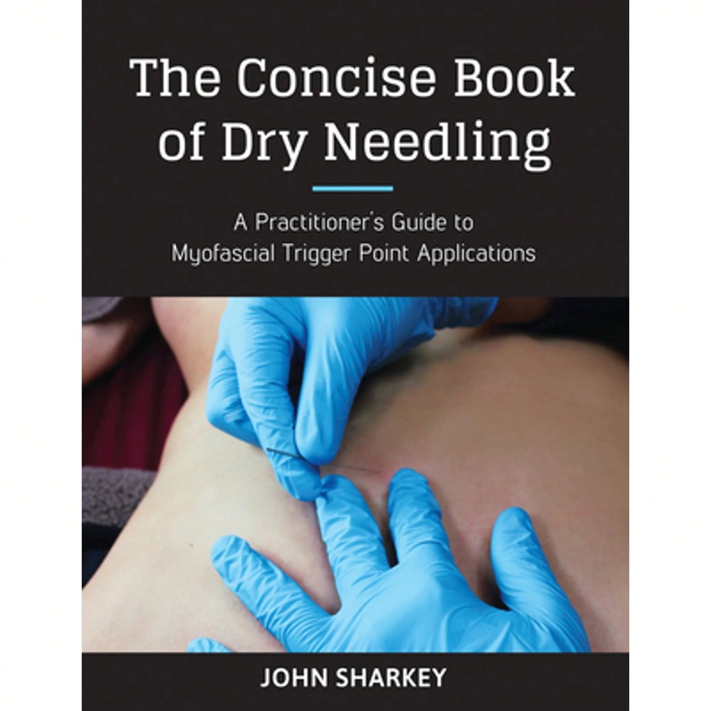 Pre-Owned The Concise Book Of Dry Needling: A Practitioner's Guide To Myofascial Trigger Point (Paperback) By John Sharkey